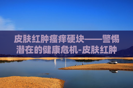皮肤红肿瘙痒硬块——警惕潜在的健康危机-皮肤红肿瘙痒硬块发热