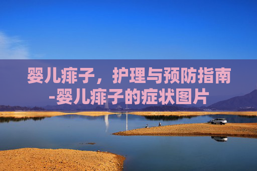 婴儿痱子，护理与预防指南-婴儿痱子的症状图片