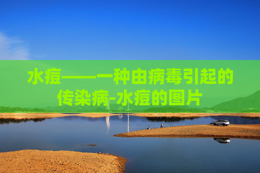 水痘——一种由病毒引起的传染病-水痘的图片