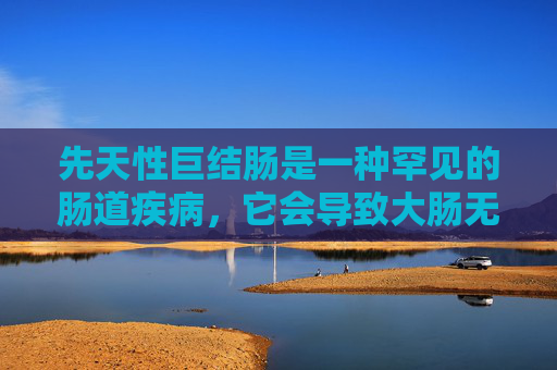 先天性巨结肠是一种罕见的肠道疾病，它会导致大肠无法正常扩张和蠕动，从而引起一系列症状。了解这些症状对于及时诊断和治疗至关重要。-先天性巨结肠有什么症状严重吗?
