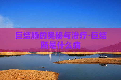 巨结肠的奥秘与治疗-巨结肠是什么病