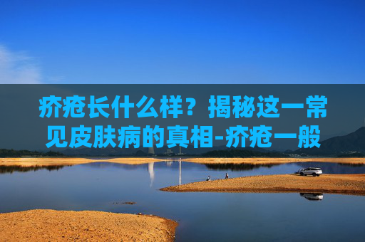 疥疮长什么样？揭秘这一常见皮肤病的真相-疥疮一般长在哪些部位