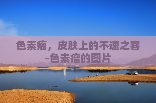 色素瘤,皮肤上的不速之客-色素瘤的图片 色素瘤,皮肤上的不速之客-色素瘤的图片