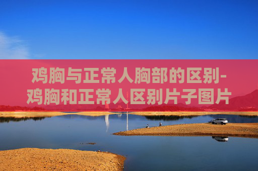 鸡胸与正常人胸部的区别-鸡胸和正常人区别片子图片