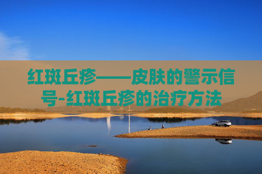 红斑丘疹——皮肤的警示信号-红斑丘疹的治疗方法