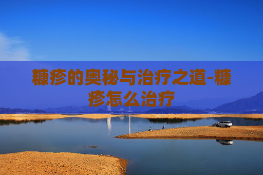 糠疹的奥秘与治疗之道-糠疹怎么治疗