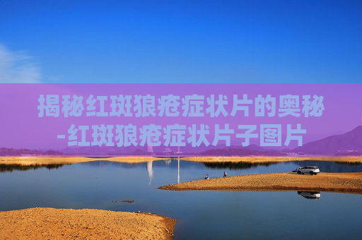 揭秘红斑狼疮症状片的奥秘-红斑狼疮症状片子图片