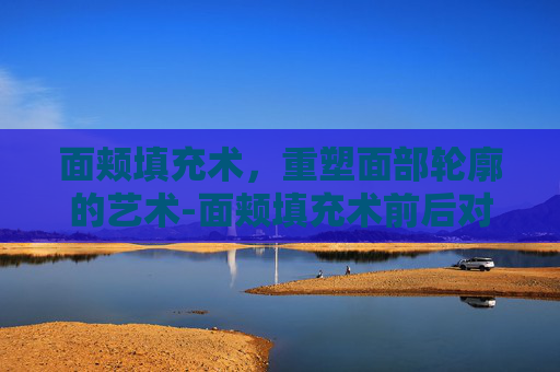 面颊填充术，重塑面部轮廓的艺术-面颊填充术前后对比