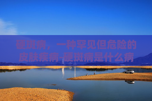 硬斑病，一种罕见但危险的皮肤疾病-硬斑病是什么病